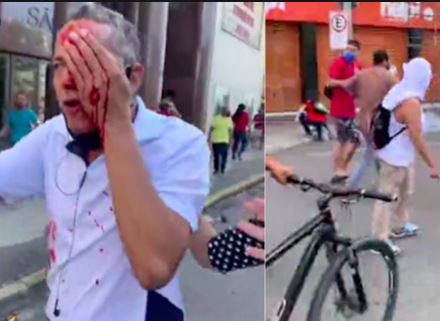 Em RECIFE: Polícia Militar ataca e agride  manifestantes anti-Bolsonaro. Uso desproporcional da força é gritante. Comandante da operação é afastado