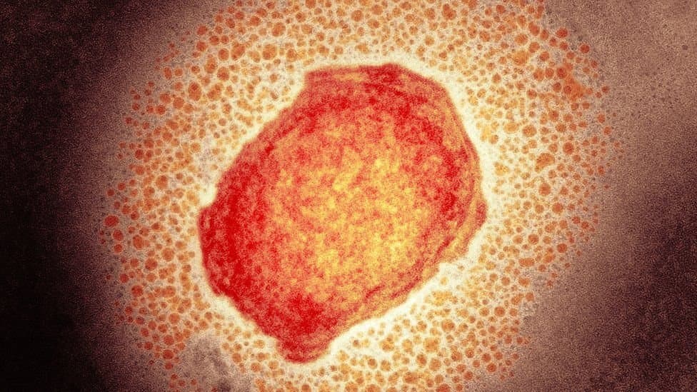 Paraíba confirma primeiro caso de Monkeypox e seis ocorrências em investigação